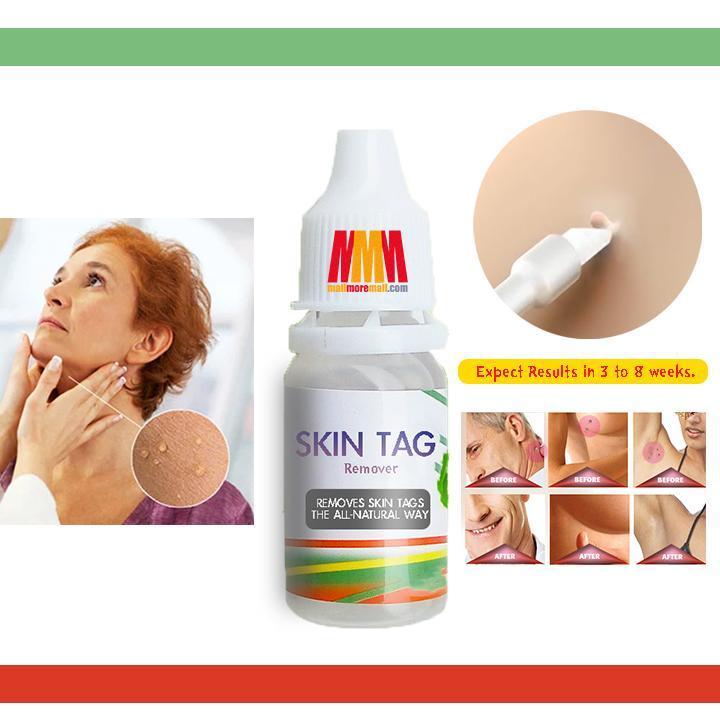 Skin Tag Remover