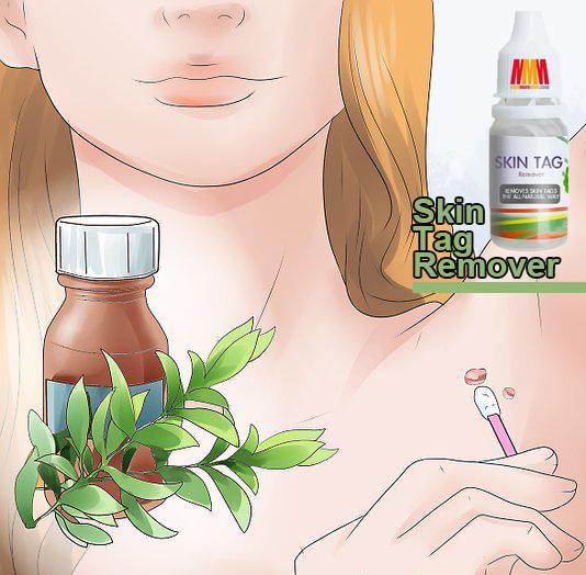 Skin Tag Remover