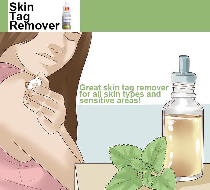 Skin Tag Remover