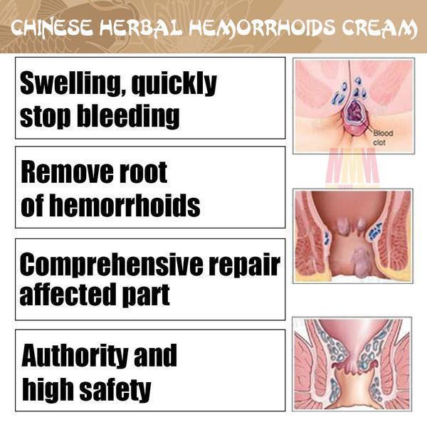 Chinese Herbal Hemorrhoids Cream