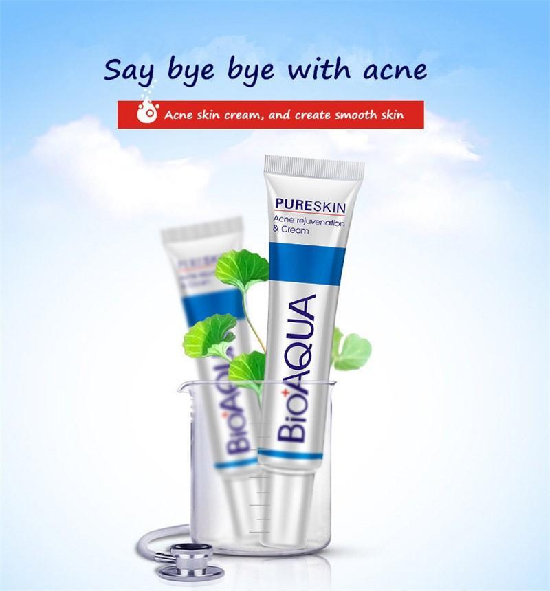 Body Acne Treatment Cream