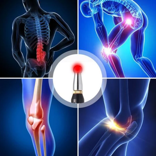 ELECTRONIC ACUPUNCTURE PEN (BUY 2+ TO GET 15% OFF)