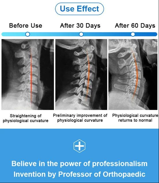 50% off today!BrighterUpTM Neck Corrector (Adjustable Height)