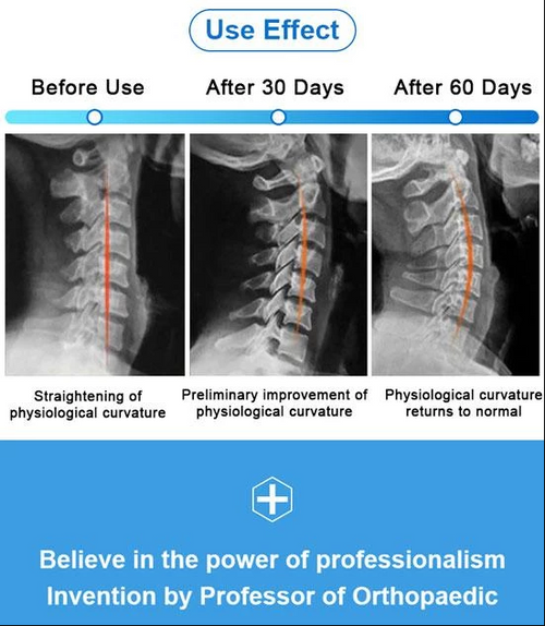 50% off today!BrighterUpTM Neck Corrector (Adjustable Height)