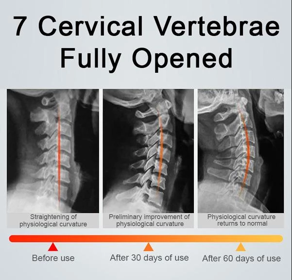 50% off today!BrighterUpTM Neck Corrector (Adjustable Height)