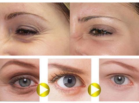 Luxury 24K Gold Under-Eye Roller