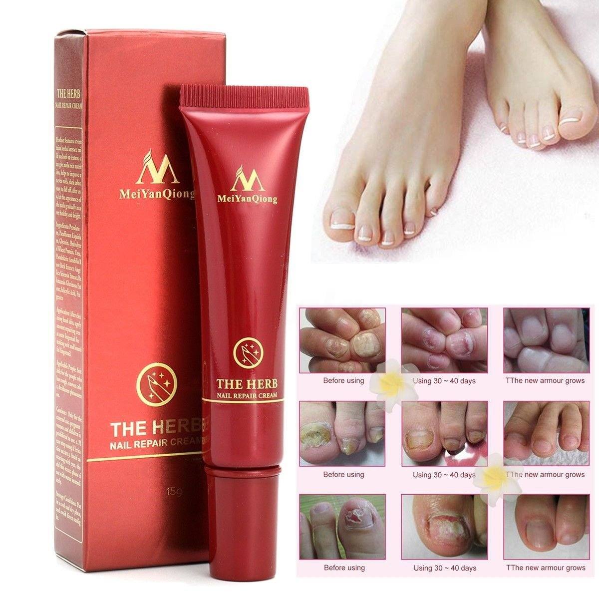 Nail Treatment Cream